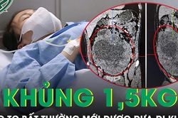 Người phụ nữ 42 tuổi mang khối u 1,5 kg trong ổ bụng mà không hay biết