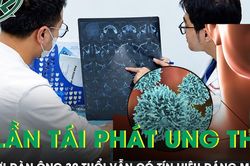 Người đàn ông 3 lần tái phát ung thư tuyến giáp