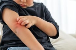 Trẻ nhỏ khi nào nên tẩy giun?