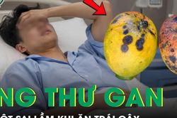 Ngày nào cũng ăn trái cây, chủ cửa hàng bất ngờ mắc ung thư gan