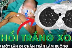 Thanh niên 20 tuổi phổi trắng xóa sau một lần đi chân trần làm ruộng