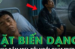 Người đ&agrave;n &ocirc;ng bị biến dạng khu&ocirc;n mặt sau khi dầm mưa rồi ngồi quạt trực tiếp