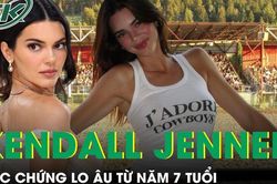 Người mẫu Kendall Jenner mắc chứng lo âu từ năm 7 tuổi