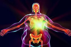Béo phì để lại dấu ấn lâu dài trong các tế bào miễn dịch