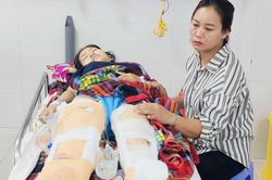 Cứu học sinh chạy ra đường, cô giáo mầm non bị xe tải cán phải cắt bỏ một chân