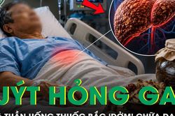 Người đàn ông 61 tuổi suýt hỏng gan sau 6 tuần uống thuốc bắc 'dởm'