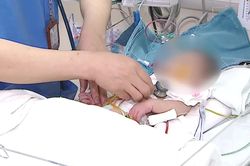 Làm chủ kỹ thuật điều trị tim bẩm sinh phức tạp