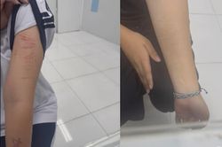 Trẻ dùng mạng xã hội quá sớm và cái giá phải trả là không nhỏ