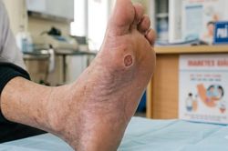 5 nhóm người không nên ngâm chân