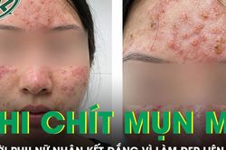 Làm đẹp liên tiếp, người phụ nữ 38 tuổi nhận cái kết đắng