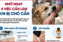 Nhớ ngay 4 việc cần làm khi bị chó cắn