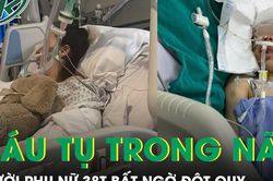 Người phụ nữ 38 tuổi bất ngờ liệt nửa người, đột quỵ xuất huyết não
