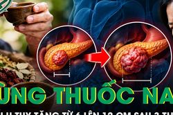 Ba tháng dùng thuốc nam, khối u tụy tăng từ 6 lên 12 cm
