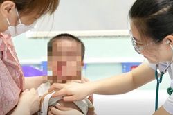 Bé 11 tháng tuổi mắc viêm ruột khởi phát sớm do đột biến gene hiếm gặp