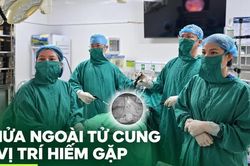 Hiếm gặp: Thai làm tổ giữa hai lớp dây chằng rộng