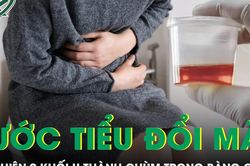 Nước tiểu chuyển màu, phát hiện 9 khối u thành chùm trong bàng quang