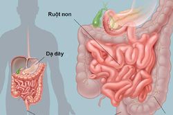 5 sai lầm khi chăm sóc người cao tuổi bị khó tiêu kéo dài