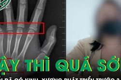 Bé gái 9 tuổi đã có kinh nguyệt, tuổi xương phát triển trước gần 3 năm
