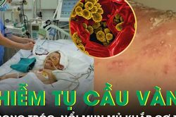 Nhiễm tụ cầu vàng, bé trai 3 tuổi da bong tróc, nổi mụn mủ khắp cơ thể