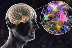 Hy vọng mới cho bệnh nhân Alzheimer nhờ công nghệ 3D