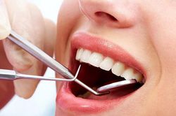 Những thói quen âm thầm làm hỏng răng