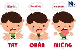 Phòng, chống bệnh tay chân miệng và các bệnh truyền nhiễm khác tại các cơ sở giáo dục