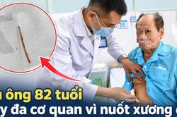 Cụ ông 82 tuổi suy đa cơ quan, sốc nhiễm trùng vì nuốt phải xương cá