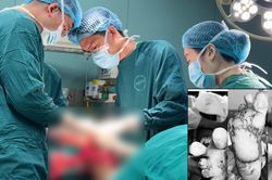 Suýt mất 2 bàn chân vì tự chườm nóng tại nhà khi bị tê bì
