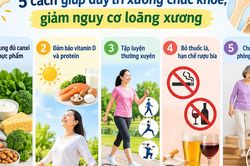 5 cách giúp duy trì xương chắc khỏe, giảm loãng xương