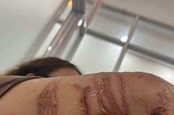 Cảnh báo loài sứa gây ngứa mạnh xuất hiện trên biển ở Quảng Ninh