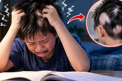 Ôn thi căng thẳng, bé trai tự nhổ tóc đến trơ từng mảng da đầu