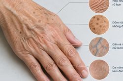 Vì sao da tay dễ lộ tuổi tác?