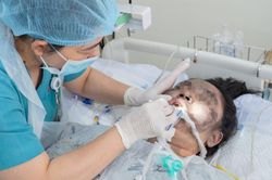 Thiếu nữ bỏng 91% cơ thể, nguy kịch sau vụ cháy nhà 4 tầng tại TPHCM