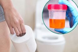 Không chủ quan khi tiểu ra máu