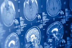 Phát hiện bất ngờ: Não người là hai cơ quan riêng biệt