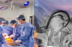 Ca cấy ghép thiết bị hỗ trợ tim CorHeart 6 đầu tiên tại Việt Nam