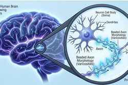 Não người không giống hình vẽ 100 năm qua trong sách giáo khoa