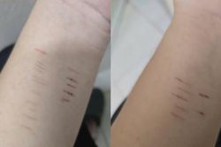 Trẻ có biểu hiện tự hại, cha mẹ phải làm gì?