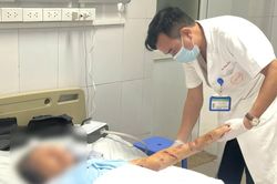 Hai người cao tuổi bị chó nhà cắn, bác sĩ cảnh báo