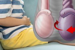 Đau bìu nhưng ngại không nói, cậu bé 14 tuổi suýt mất tinh hoàn