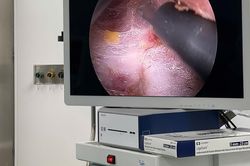 Phẫu thuật nội soi tuyến giáp – thêm lựa chọn cho bệnh nhân tại BV Bạch Mai cơ sở Ninh Bình
