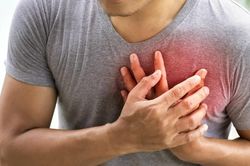 Vì sao người trẻ phải can thiệp tim mạch ngày càng nhiều?