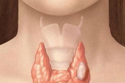 Những người nào có nguy cơ mắc ung thư tuyến giáp?