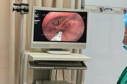 Người đàn ông 56 tuổi bị kiến chui vào thanh quản từ 1 việc không ngờ tới