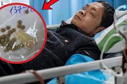 Người đàn ông suy gan vì tự uống thuốc chữa xơ gan, vàng da gấp 42 lần