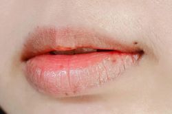 Môi khô, bong tróc khi trời vào thu, đừng bỏ qua những thói quen này