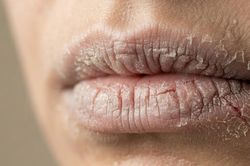 Lý do môi khô, da môi dễ bong vào mùa thu và cách khắc phục