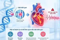 Ngất không rõ nguyên nhân, cảnh giác rối loạn nhịp tim do gene