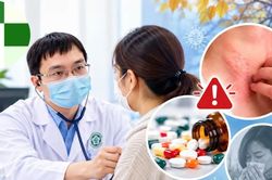 Giao mùa tự mua thuốc, coi chừng dị ứng thuốc diễn biến nặng