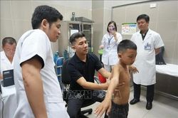 Đảm bảo tối đa quyền trẻ em